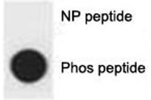 Dot blot analysis of p-p62 antibody. (SQSTM1 Antikörper  (pSer403))