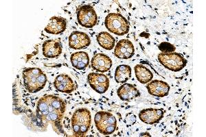 Phospho-HSF1 (Ser326) Antibody at 1/100 staining Rat stomach tissue by IHC-P.