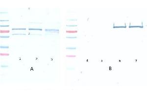Western Blot of Mouse Anti-Akt pS473 antibody. (AKT1 Antikörper  (pSer473))