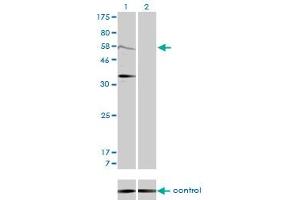 Western blot analysis of MDM2 over-expressed 293 cell line, cotransfected with MDM2 Validated Chimera RNAi (Lane 2) or non-transfected control (Lane 1). (MDM2 Antikörper  (AA 101-200))