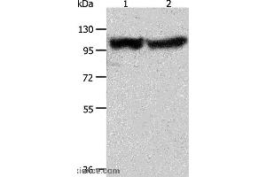 Western blot analysis of Human fetal muscle tissue and hela cell, using ACTN3 Polyclonal Antibody at dilution of 1:400 (ACTN3 Antikörper)