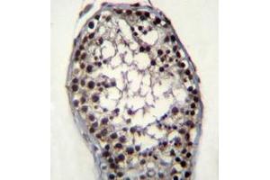Immunohistochemistry analysis in formalin fixed and paraffin embedded human testis tissue reacted with Glycerol kinase Antibody (N-term) followed by peroxidase conjugation of the secondary antibody and DAB staining. (Glycerol Kinase Antikörper  (N-Term))