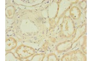 Immunohistochemistry of paraffin-embedded human kidney tissue using ABIN7172078 at dilution of 1:100 (TARS2 Antikörper  (AA 369-718))