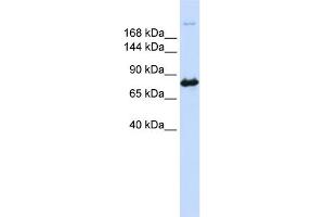 WB Suggested Anti-CAD Antibody Titration:  0.