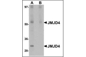 Western blot analysis of JMJD4 in human spleen tissue lysate with this product at 1 μg/ml in (A) the absence and (B) the presence of blocking peptide. (JMJD4 Antikörper  (N-Term))