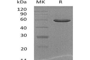 Western Blotting (WB) image for Carboxypeptidase Q (CPQ) protein (His tag) (ABIN7320627) (CPQ Protein (His tag))