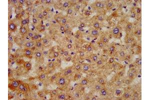 IHC image of ABIN7155981 diluted at 1:300 and staining in paraffin-embedded human liver tissue performed on a Leica BondTM system. (HAO1 Antikörper  (AA 161-273))