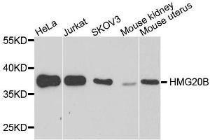 Western blot analysis of extracts of various cell lines, using HMG20B antibody. (HMG20B Antikörper  (AA 1-317))