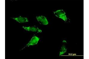 Immunofluorescence of purified MaxPab antibody to PDHA2 on HeLa cell. (PDHA2 Antikörper  (AA 1-388))