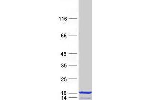 Western Blotting (WB) image for S100 Calcium Binding Protein A7 (S100A7) protein (Myc-DYKDDDDK Tag) (ABIN2712363)