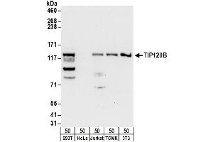 anti-Cullin-Associated and Neddylation-Dissociated 2 (CAND2) (AA 1186-1236) antibody