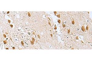 Immunohistochemistry of paraffin-embedded Human brain tissue using KDM2B Polyclonal Antibody at dilution of 1:50(x200)