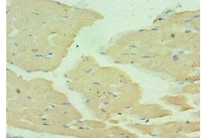 Immunohistochemistry of paraffin-embedded human skeletal muscle tissue using ABIN7160559 at dilution of 1:100 (MYH1 Antikörper  (AA 1-100))