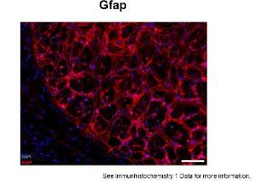 Sample Type: human optic nerve head (frozen)Blue: DAPIRed: GfapPrimary Dilution: 1:250Image Submitted By: Geraint ParfittGavin Herbert Eye Institute .