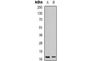 Western blot analysis of LMO3 expression in human heart (A), COS7 (B) whole cell lysates.