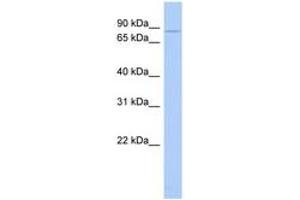 Image no. 1 for anti-Choroideremia (Rab Escort Protein 1) (CHM) (AA 35-84) antibody (ABIN6744369) (CHM Antikörper  (AA 35-84))