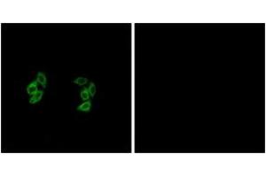 Immunofluorescence analysis of A549 cells, using CKI-alpha1/L Antibody.