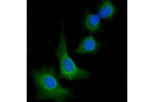 IF analysis of VPS53 using anti-VPS53 antibody (ABIN7599731). (VPS53 Antikörper  (AA 11-699))
