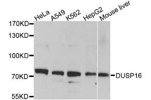 Western blot analysis of extracts of various cell lines, using DUSP16 antibody. (DUSP16 Antikörper  (AA 416-665))