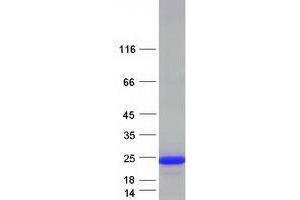 Western Blotting (WB) image for Nudix (Nucleoside Diphosphate Linked Moiety X)-Type Motif 3 (NUDT3) protein (Myc-DYKDDDDK Tag) (ABIN2727760)