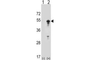 Western Blotting (WB) image for anti-Signal Transducing Adaptor Molecule (SH3 Domain and ITAM Motif) 1 (STAM) antibody (ABIN3001494) (STAM Antikörper)