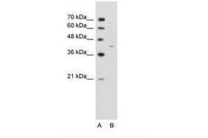 Image no. 1 for anti-GNAS Complex Locus (GNAS) (AA 297-346) antibody (ABIN203496) (GNAS Antikörper  (AA 297-346))