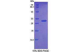 SDS-PAGE analysis of Rat GDF11 Protein.