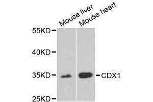 Western blot analysis of extracts of various cell lines, using CDX1 antibody.