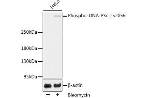 Western blot analysis of extracts of HeLa cells, using Phospho-DNA-PKcs-S2056 antibody (ABIN6135292, ABIN6136206, ABIN6136207 and ABIN6225632). (PRKDC Antikörper  (pSer2056))