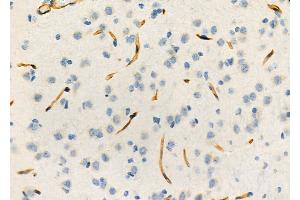 ABIN6264216 and ABIN6273297 at 1/100 staining Rat brain tissue by IHC-P. (PIK3IP1 Antikörper  (N-Term))