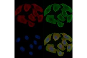 ABIN7096880 and ABIN7100946 staining Hela cells(30 min of UV treatment) by IF/ICC.