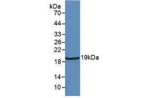 Detection of Recombinant IL18, Rat using Monoclonal Antibody to Interleukin 18 (IL18) (IL-18 Antikörper  (AA 37-194))