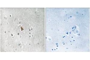Immunohistochemistry (IHC) image for anti-Insulin-Like Growth Factor 1 Receptor (IGF1R) (AA 1311-1360), (pTyr1346) antibody (ABIN1532017)