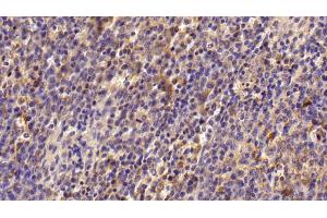 Immunohistochemistry (IHC) image for anti-Transglutaminase 2 (C Polypeptide, Protein-Glutamine-gamma-Glutamyltransferase) (TGM2) (AA 1-687) antibody (ABIN7434158)