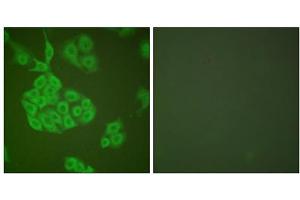 Immunofluorescence analysis of A549 cells, using MMP11 antibody (ABIN5976457). (MMP11 Antikörper  (Internal Region))