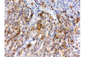 Immunohistochemistry (IHC) image for anti-Selectin P (Granule Membrane Protein 140kDa, Antigen CD62) (SELP) (AA 42-271) antibody (ABIN3043327)