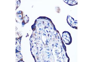 Immunohistochemistry of paraffin-embedded human placenta using Alkaline Phosphatase (ALPL) (ALPL) Rabbit mAb (ABIN7265551) at dilution of 1:100 (40x lens). (ALPL Antikörper)
