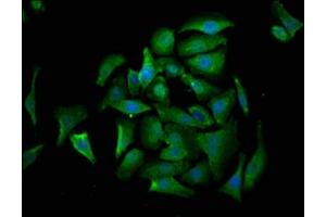 Immunofluorescence staining of A549 cells with ABIN7149542 at 1:530, counter-stained with DAPI. (CRADD Antikörper  (AA 1-199))