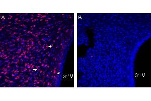 Expression of P2X3 in mouse paraventricular nucleus of the hypothalamus (PVN).
