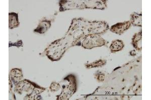 Image no. 1 for anti-Zic Family Member 4 (ZIC4) (AA 249-320) antibody (ABIN466253) (ZIC4 Antikörper  (AA 249-320))