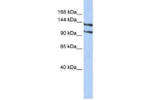 RBM5 antibody used at 1. (RBM5 Antikörper  (N-Term))