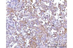 IHC analysis of RPS15A using anti-RPS15A antibody (ABIN7598954). (RPS15A Antikörper  (AA 1-113))