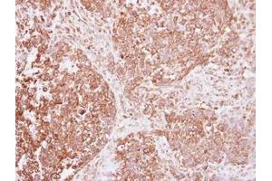Image no. 1 for anti-Insulin Receptor (INSR) (AA 816-988) antibody (ABIN1498892) (Insulin Receptor Antikörper  (AA 816-988))