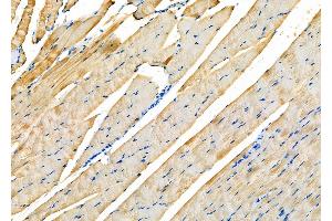 ABIN6258189 and ABIN6273887 at 1/100 staining Rat muscle tissue by IHC-P. (GPR63 Antikörper  (Internal Region))
