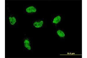 Immunofluorescence of monoclonal antibody to HOXA5 on HeLa cell. (HOXA5 Antikörper  (AA 171-270))