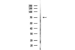 anti-Heterochromatin Protein 1, Binding Protein 3 (HP1BP3) (Internal Region) antibody