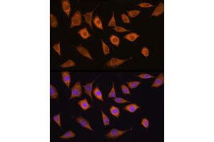 Immunofluorescence analysis of L929 cells using USP5 antibody (ABIN1683231, ABIN3018687, ABIN3018688 and ABIN6220542) at dilution of 1:100. (USP5 Antikörper  (AA 1-280))