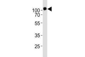 Western blot analysis of lysate from KG-1 cell line using CD34 antibody diluted at 1:1000. (CD34 Antikörper  (AA 320-354))