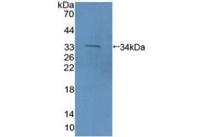 Figure. (PCDH15 Antikörper  (AA 45-270))