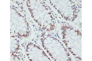 Immunohistochemistry of paraffin-embedded Human colon using Phospho-POLR2A(S5) Polyclonal Antibody at dilution of 1:100 (40x lens).